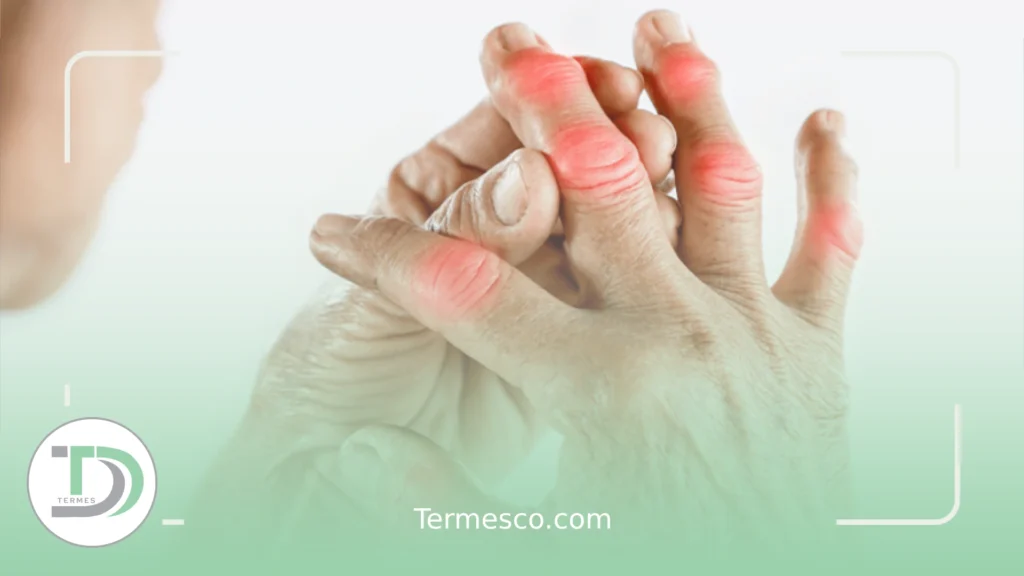 علت درد مفاصل در زنان