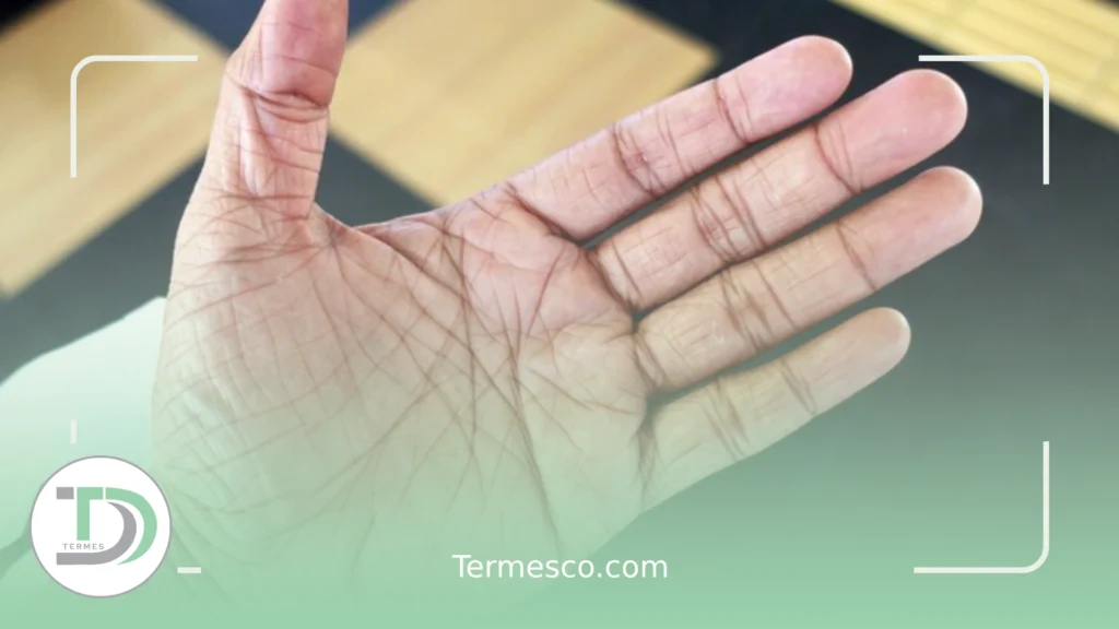 آیا بیماری رینود خطرناک است؟