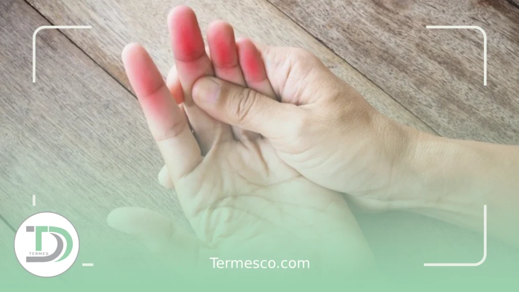 علائم شایع سندروم رینود